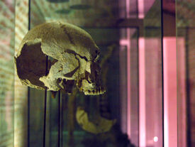 Pour le crâne : Salle d’ostéo-archéologie, crâne présentant une section frontale mortelle due à un coup d’épée ou de scramasaxe, VIème-VIIème siècle, crâne trouvé à Haudricourt en Seine-Maritime